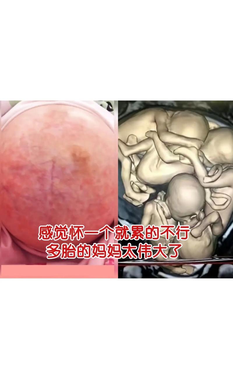 美国代孕后悔吗_美国代孕后悔吗_美国代孕后悔吗