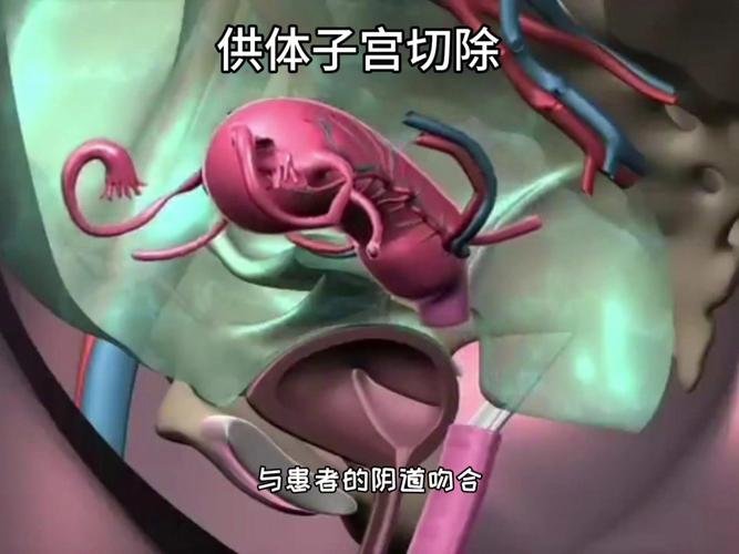 子宫切除也能拥有孩子_子宫切除了还可以做婴儿试管吗_子宫切除还能美国代孕吗
